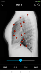 171731-6107b82b5aebd.png 轻盈医学 6.5.0