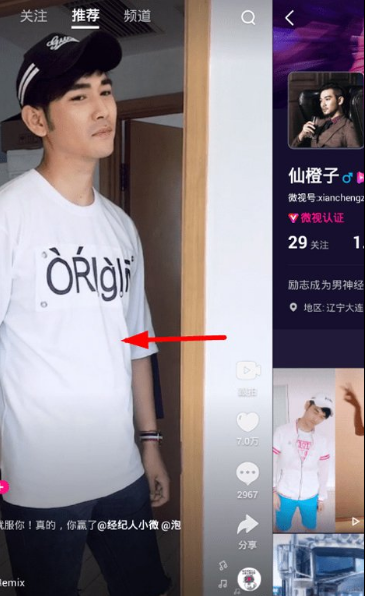微视APP中使用黑名单功能的具体方法