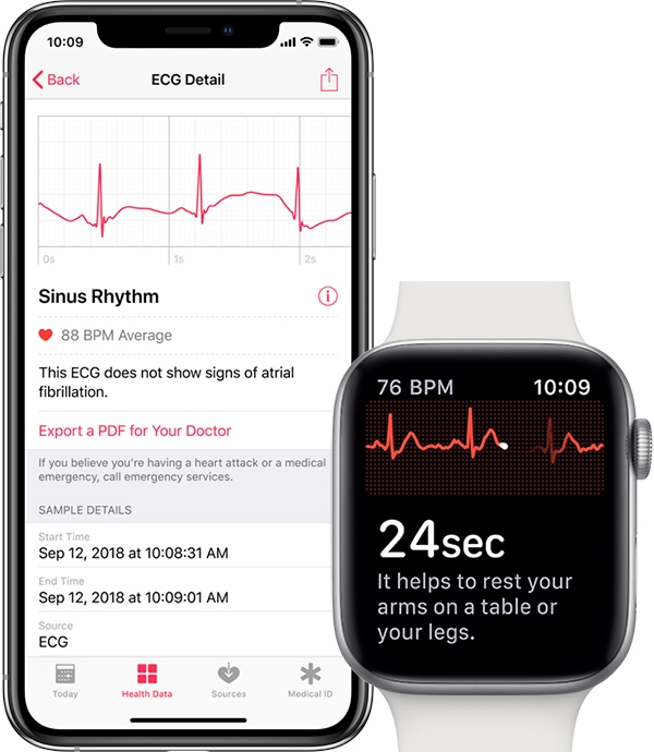 watchOS 5.1.2上线:ECG心电图功能来了