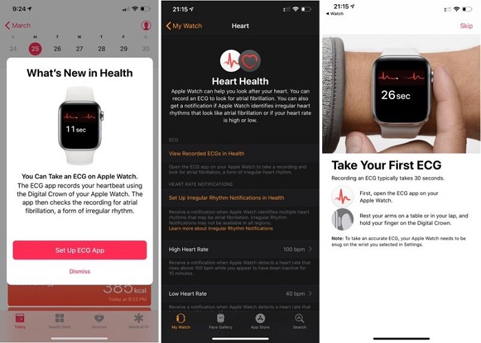 iOS 12.2透露watchOS 5.2或于欧洲上线心电监测App