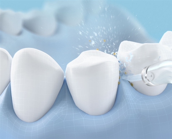 小米新上架随身冲牙器：众筹价149元