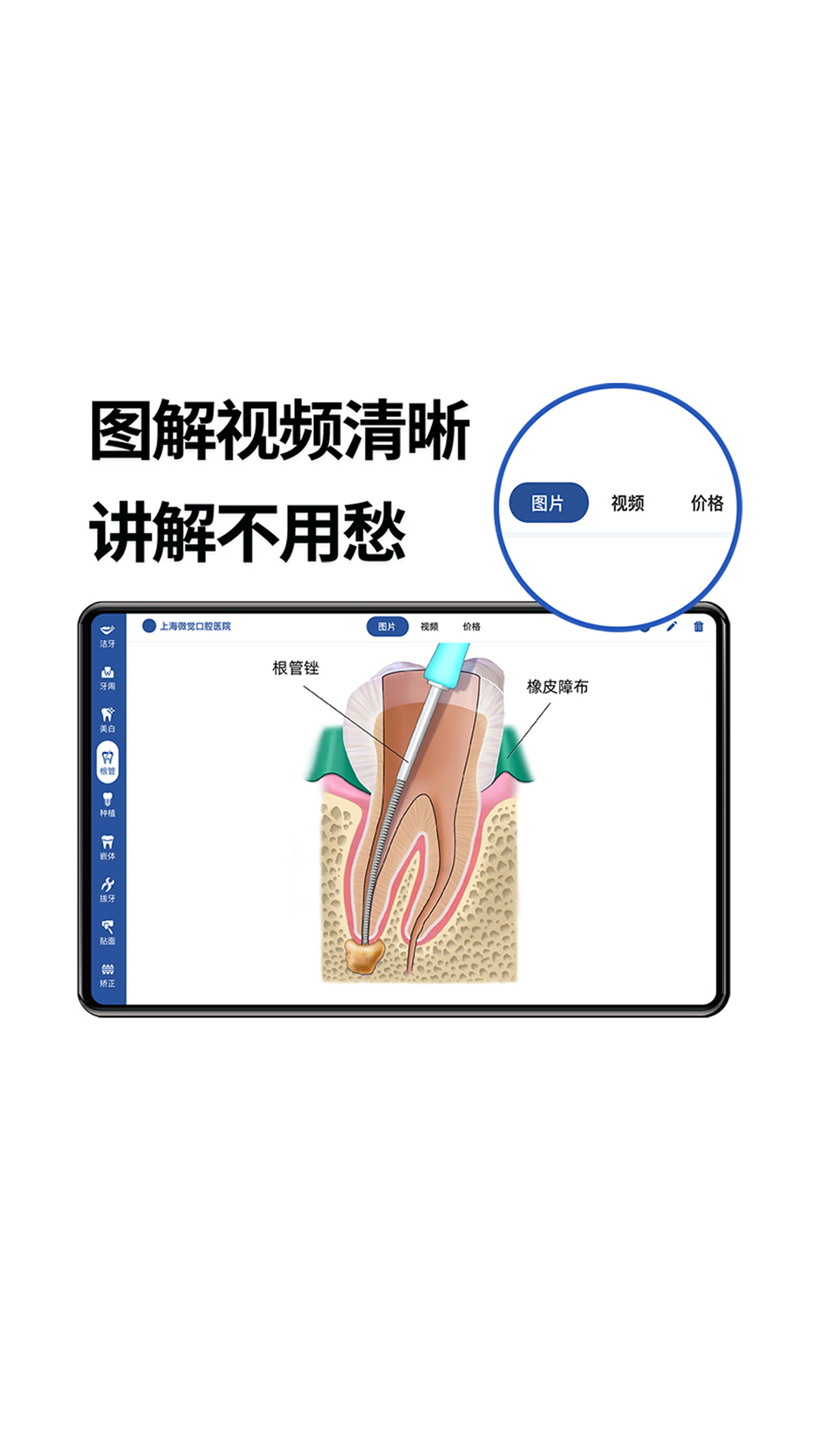 一分钟报价截图