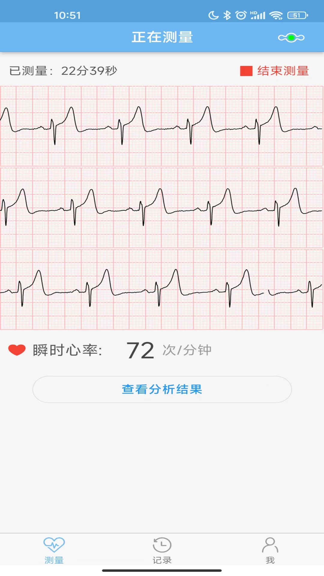 数维康心电截图