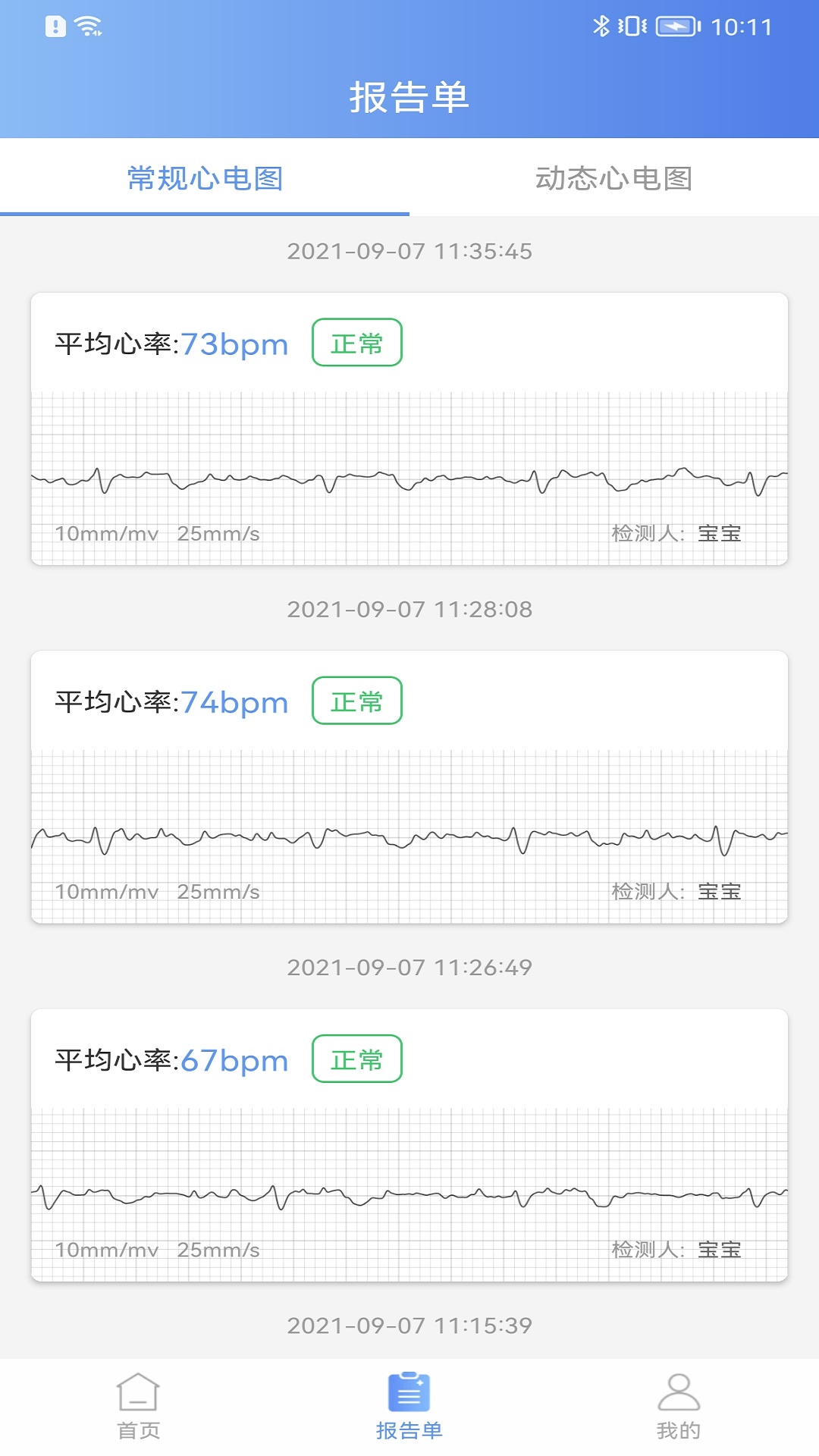 卡帕奇心电截图