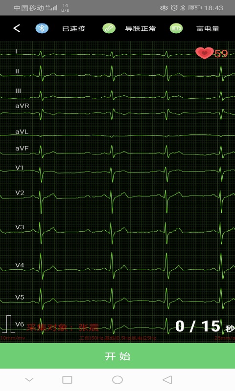 康乃心测心电截图