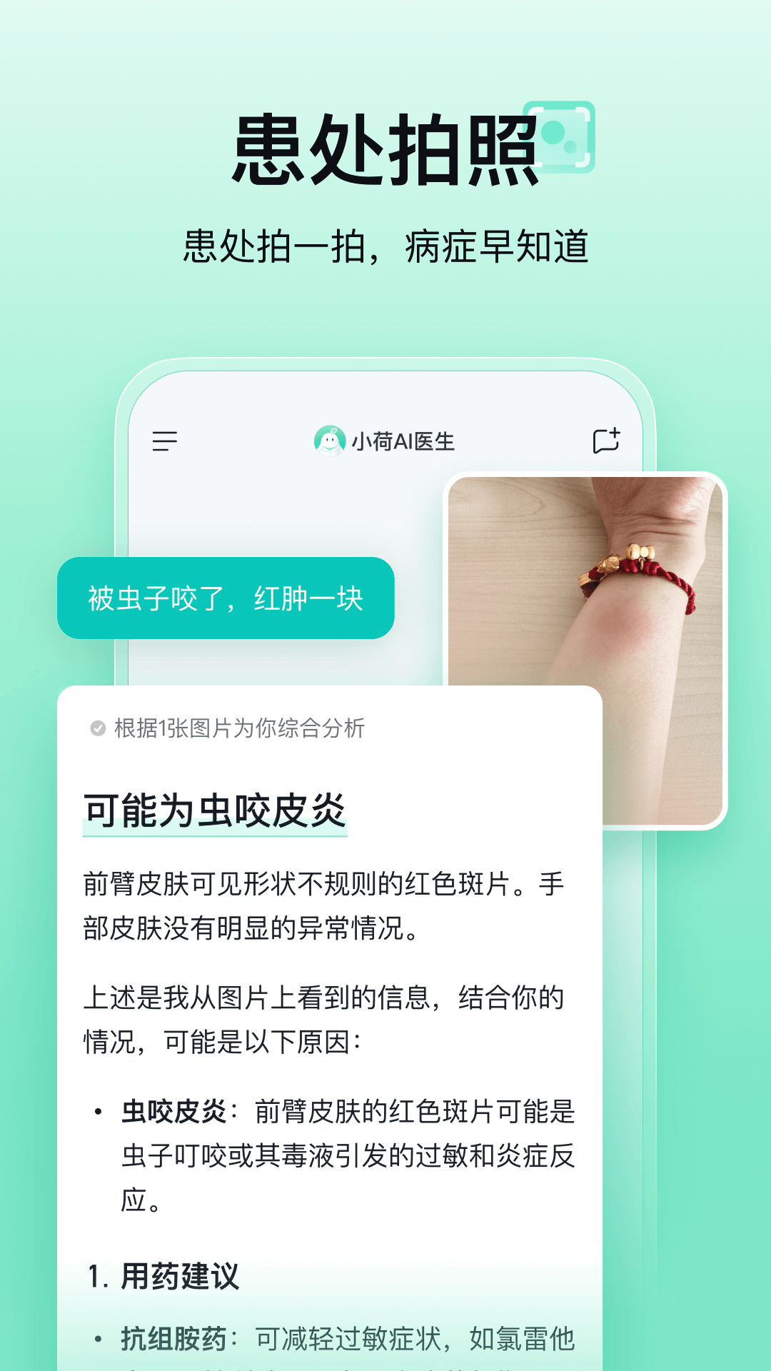 小荷AI医生截图