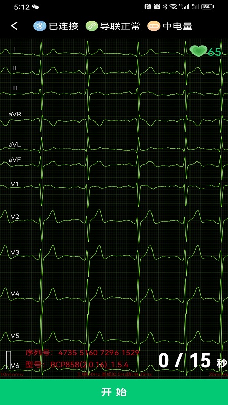 心电一张网截图