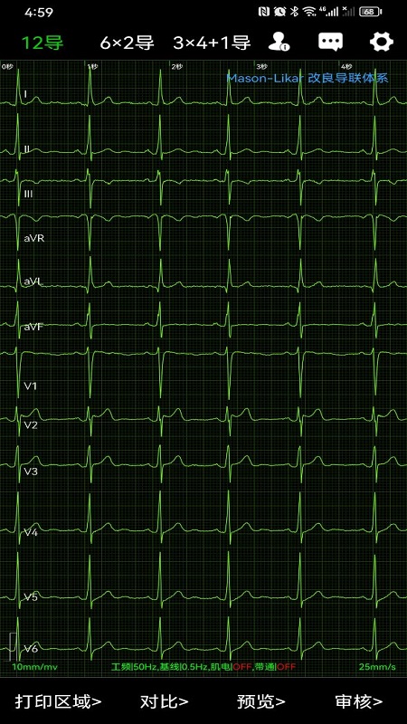 心电一张网截图
