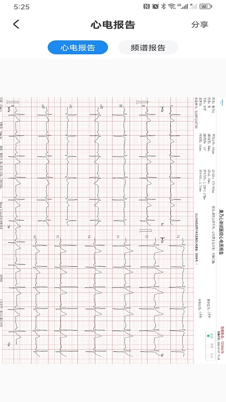 心电一张网截图