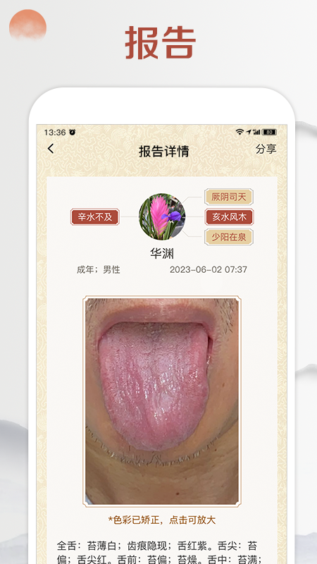 看舌头截图