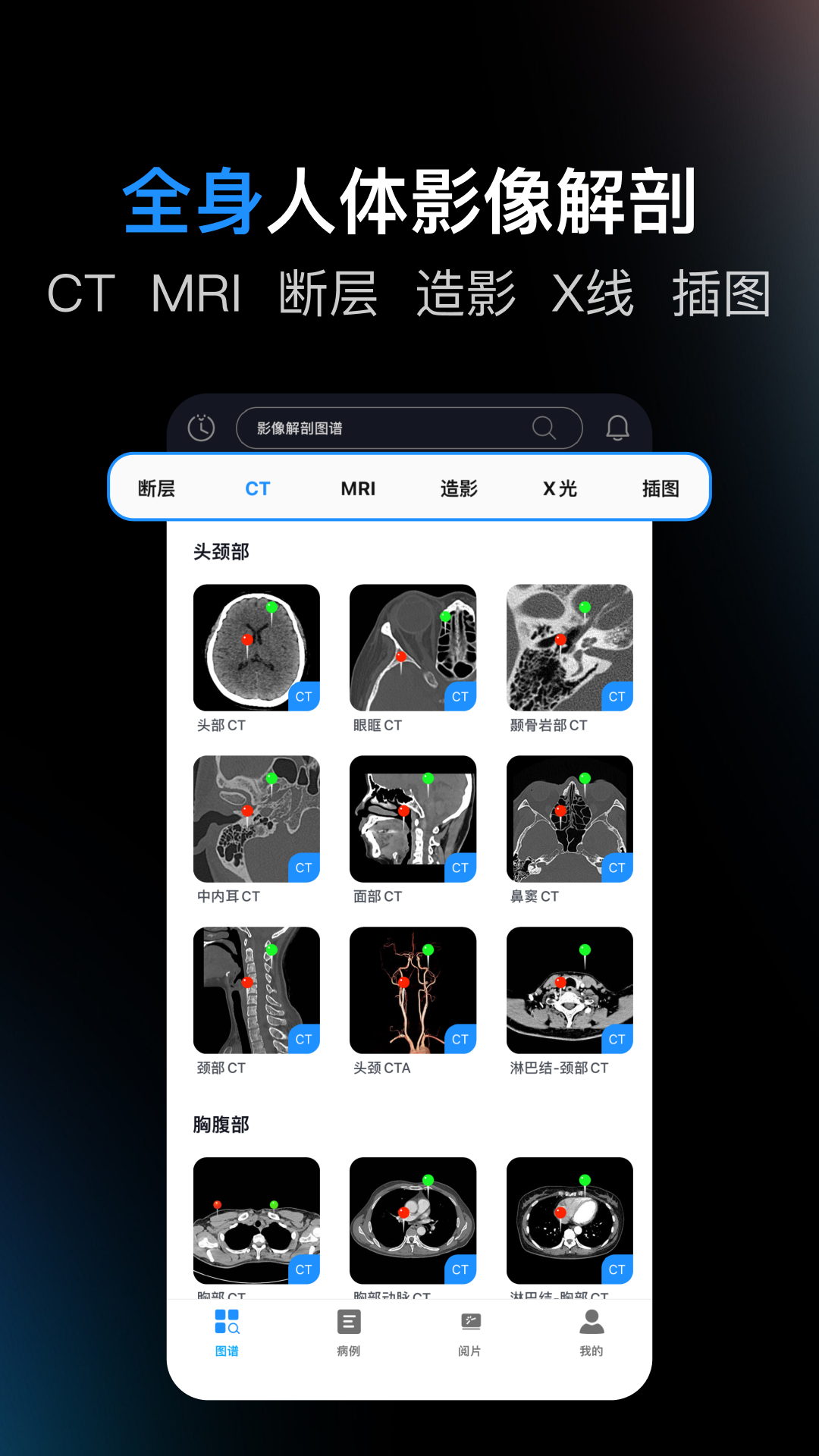 影像解剖图谱截图
