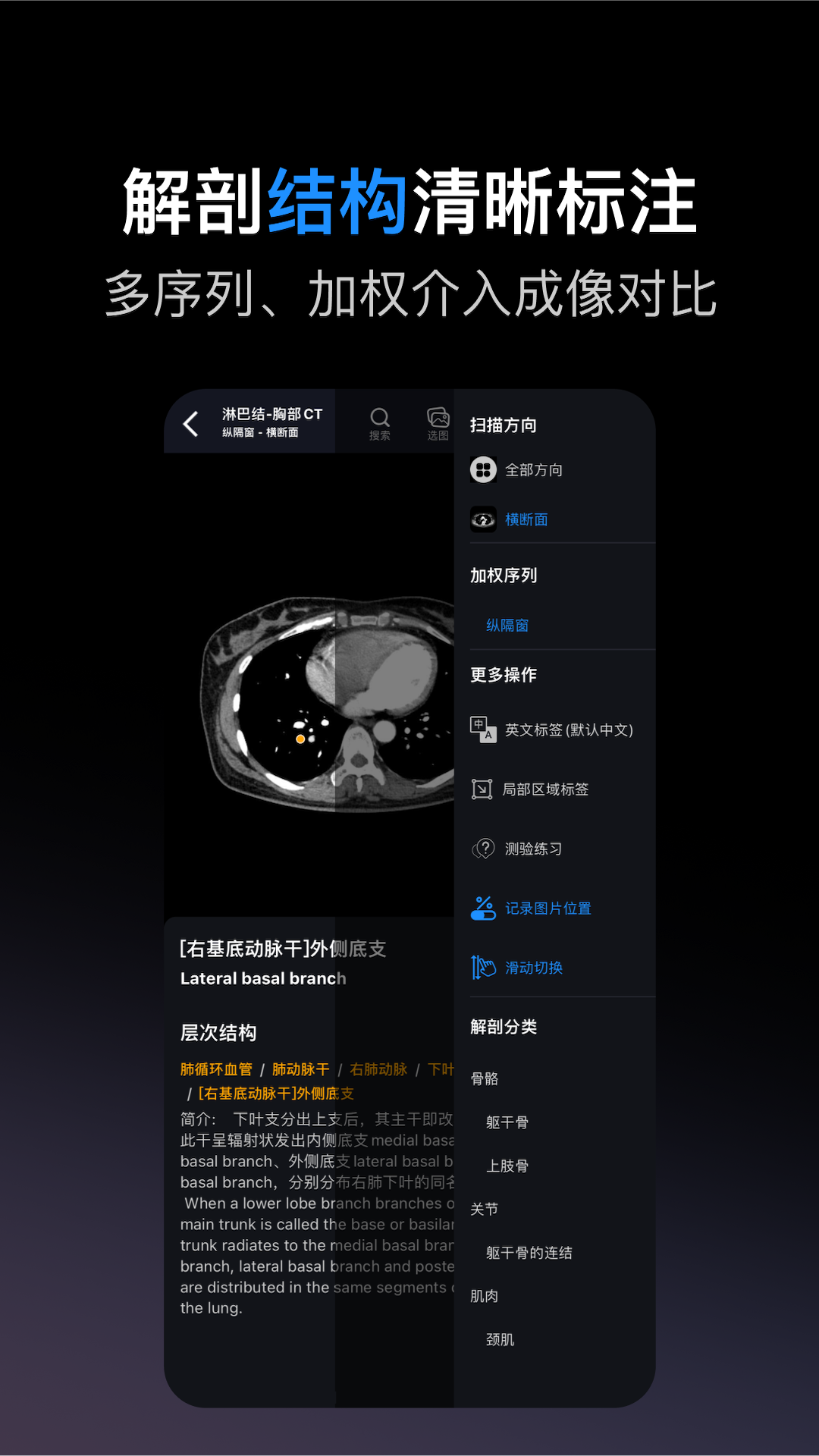 影像解剖图谱截图