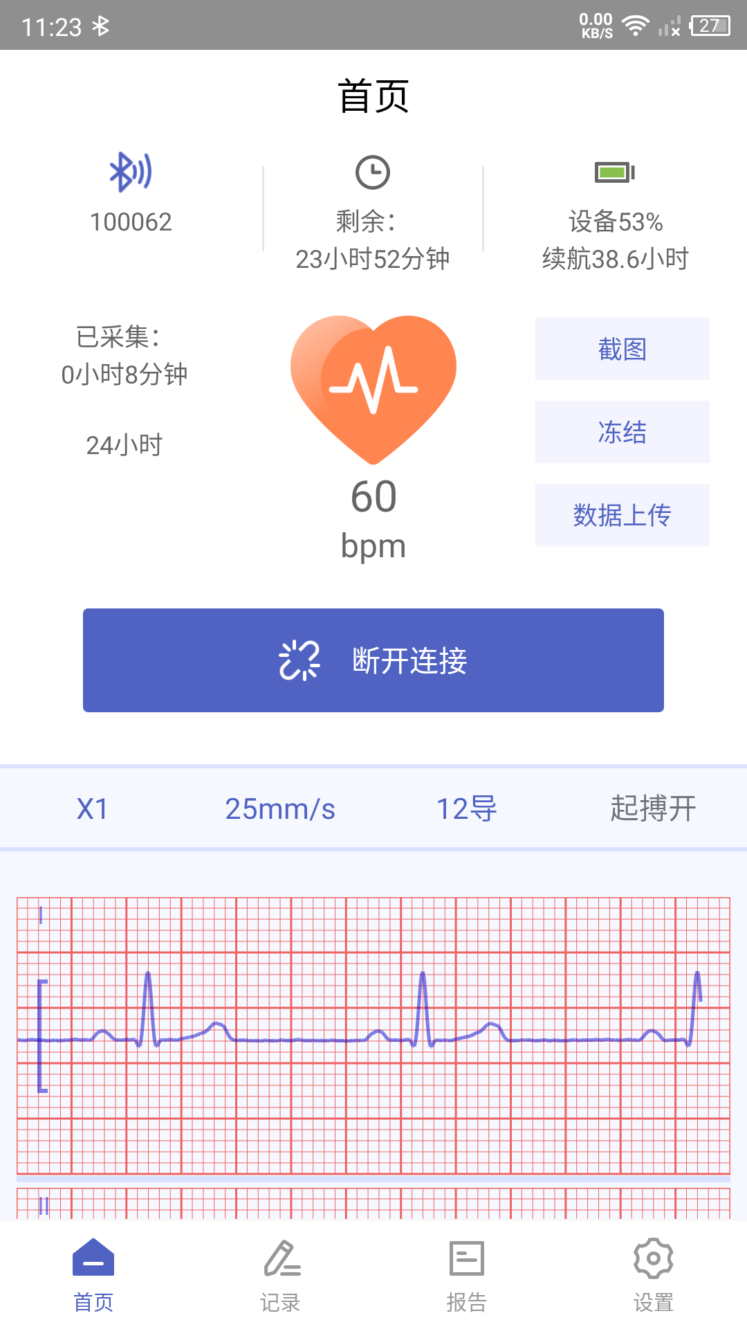 联影小智健康截图