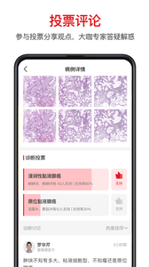 爱病理截图