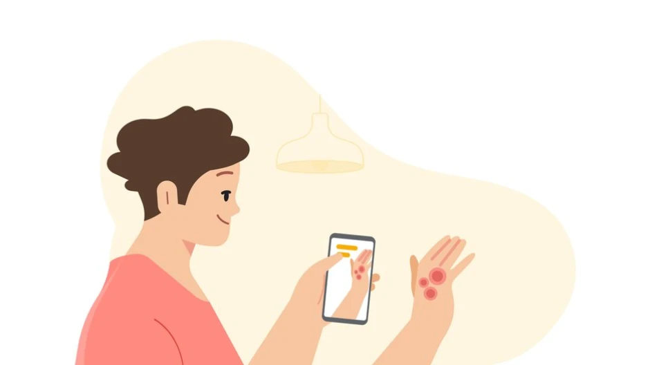 谷歌推出人性化新功能 利用 AI 工具拍照检测皮肤病