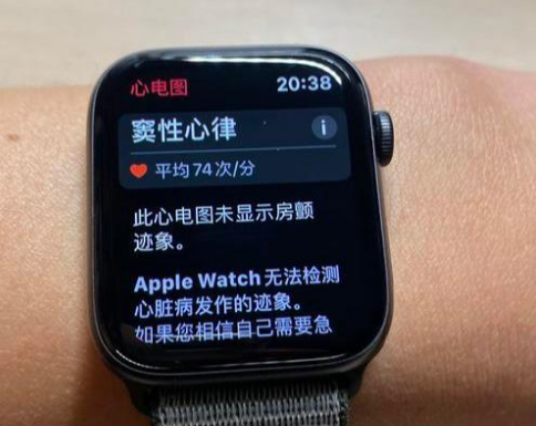 applewatch心电图怎么用?苹果手表国行心电图开启教程截图